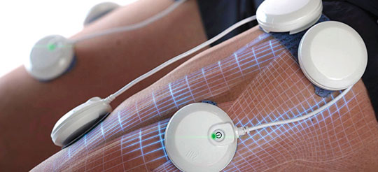 revolution-wireless-electrodes